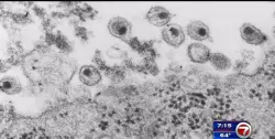 US aid cuts halt HIV vaccine research in South Africa, with global impact